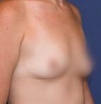 Voor