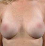 Na