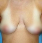 Voor