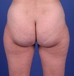 Voor