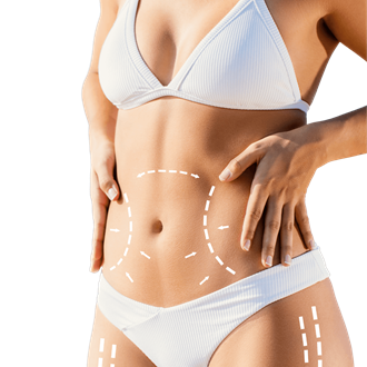 Liposuctie