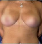 Na