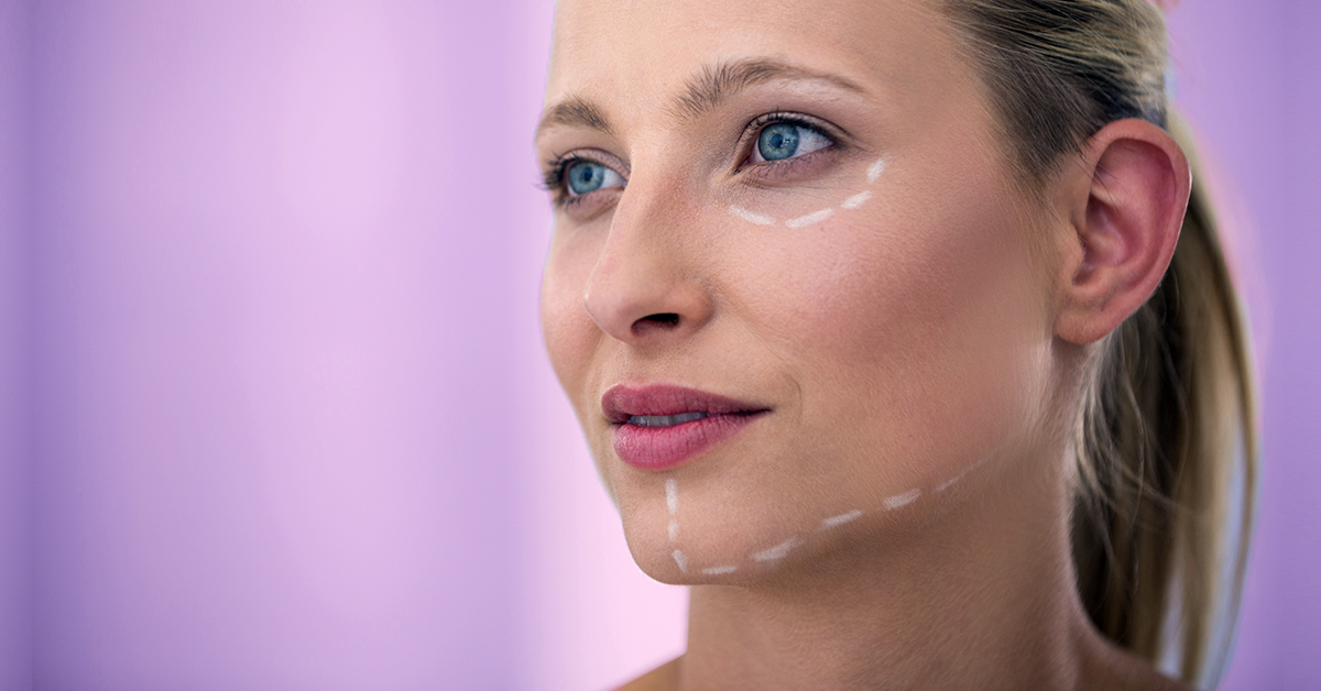 Plastische chirurgie van het gezicht is geen taboe meer