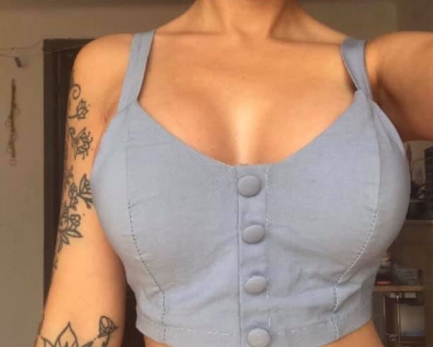 Borstvergroting met 360cc XP-implantaten 