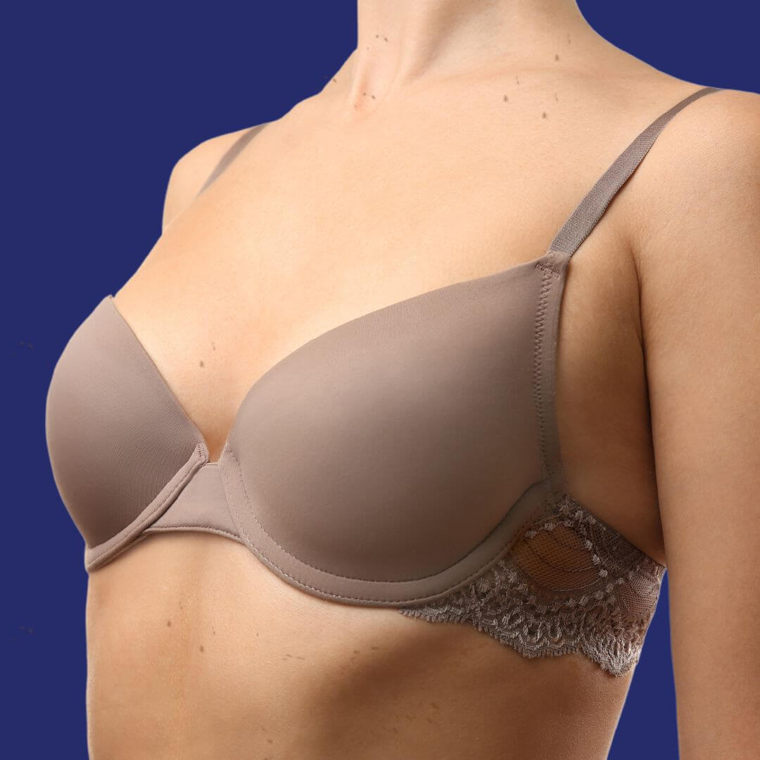 Voordat ik een borstvergroting onderging met implantaten van 265cc XP bij de Wellness Kliniek   