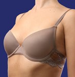 Voordat ik een borstvergroting onderging met implantaten van 265cc XP bij de Wellness Kliniek