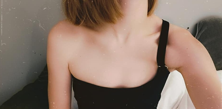 Voor Borstvergroting met implantaten van 300cc XP 