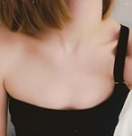 Voor Borstvergroting met implantaten van 300cc XP