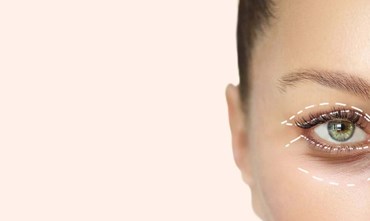 Breng het licht terug in je ogen met de hangende ooglidoperatie van Wellness Kliniek