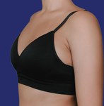 Voor Borstvergrotingsoperatie met implantaten van 240cc XXP