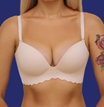 Na Foto's van een borstvergrotingsoperatie met implantaten van 360cc XP