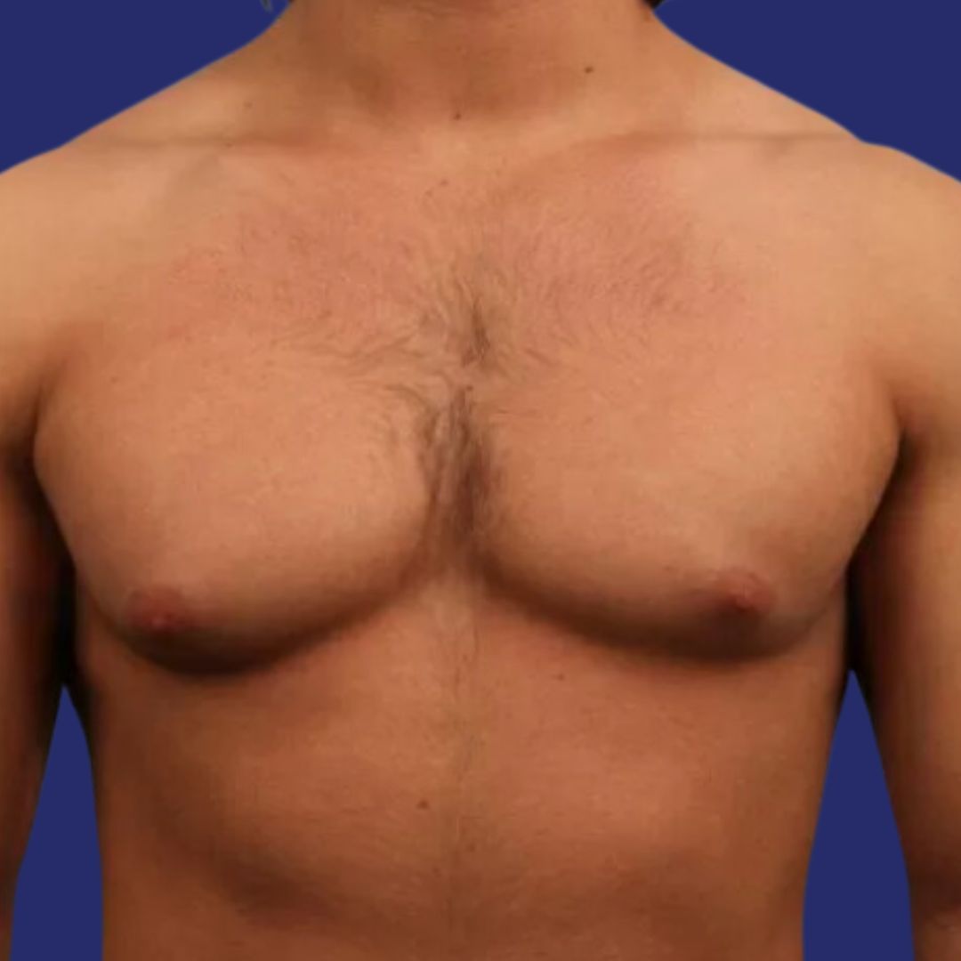 Mannelijke borst voor