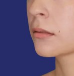 Lachende close-up van lippen met minimale blootstelling van de bovenlip.