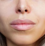 Close-up van lippen na lipfiller