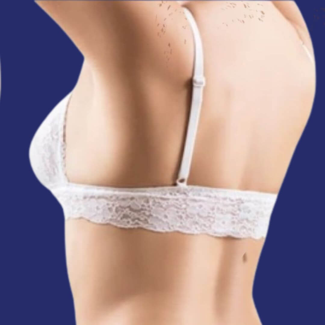 Liposuctie rug foto resultaat