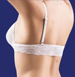 Liposuctie rug foto resultaat