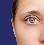 Foto van blepharoplastiek resultaten