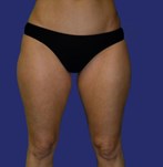 verwijder zadeltasjes en binnenbenen